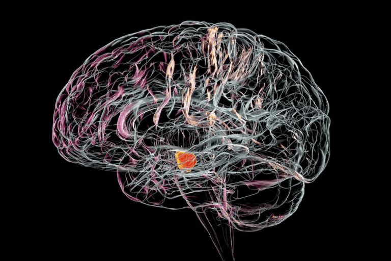 Parkinson: consejos para sobrellevar la enfermedad en el día a día